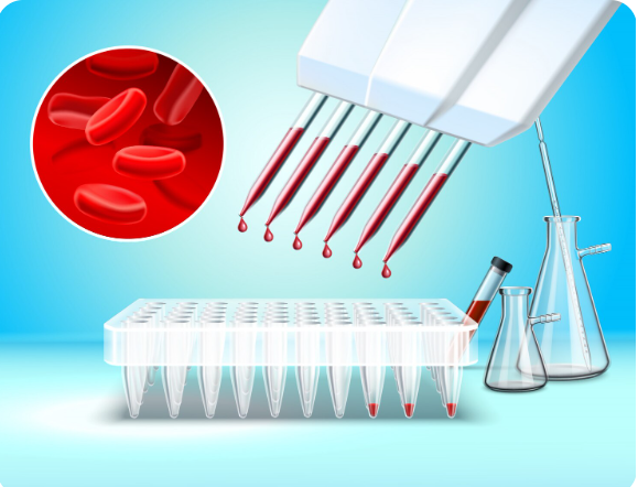 Blood sample automated pipetting in laboratory for medical diagnostic testing